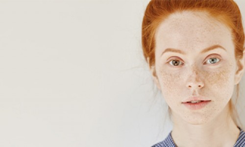 How to Cover Freckles