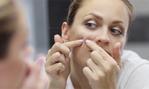 Information About Blackheads