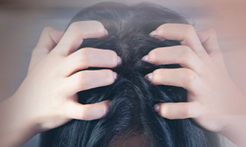 Information About Hair Dandruff