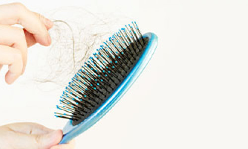 Information About Hair Loss