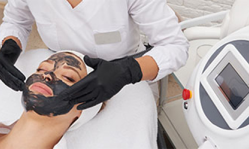 What is Carbon Peeling?