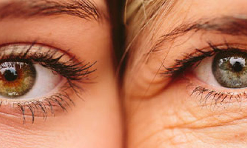 Information About Eye Wrinkles